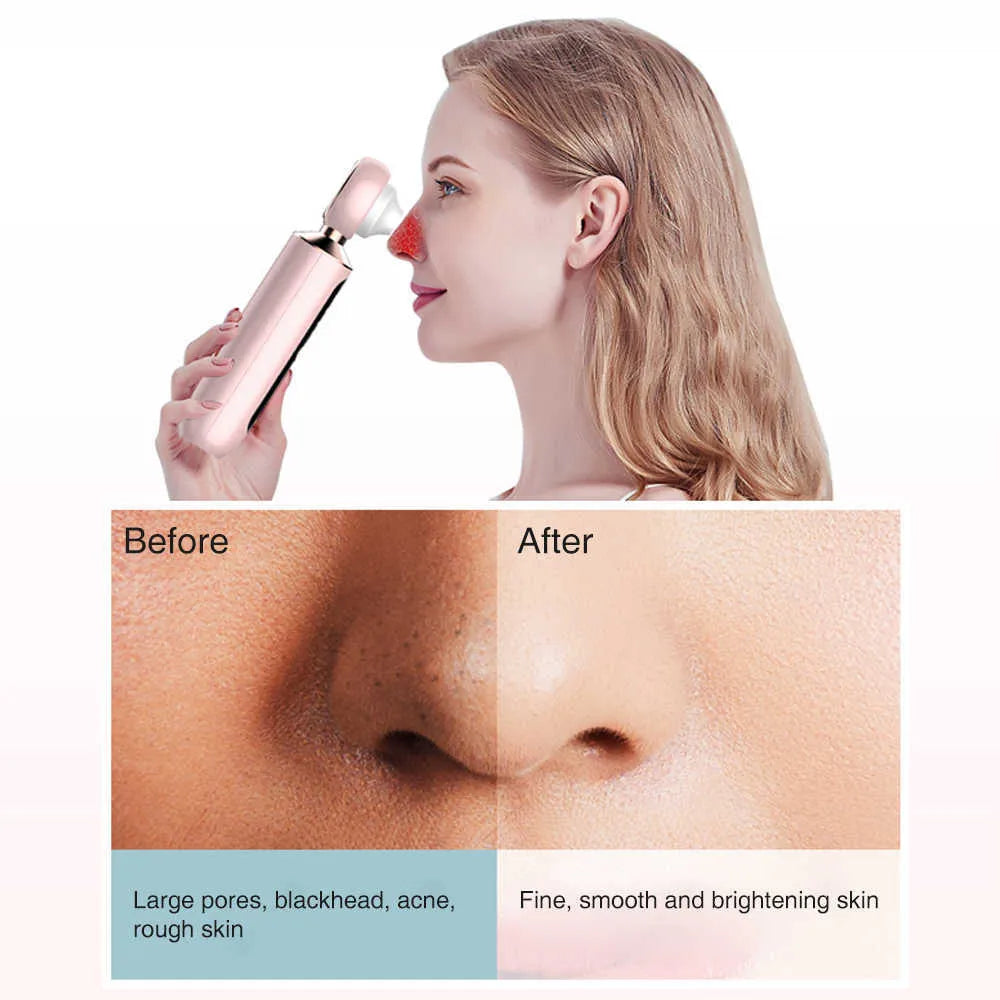 Marketplace Gulf™ Blackhead Suction Machine