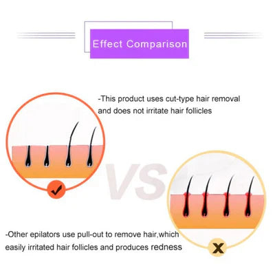 Marketplace Gulf™Purple Epilator – آلة إزالة الشعر البنفسجية