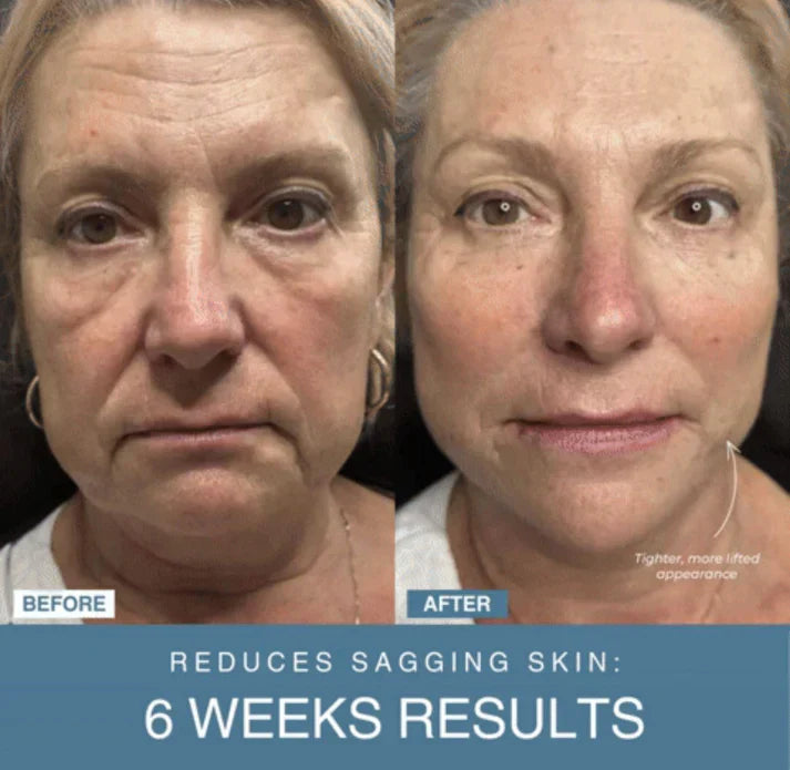 Marketplace Gulf™ 7-in-1 LED Anti-Aging/Wrinkle Apparatus