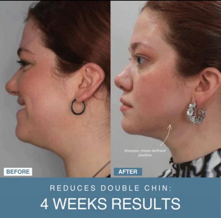Marketplace Gulf™ 7-in-1 LED Anti-Aging/Wrinkle Apparatus