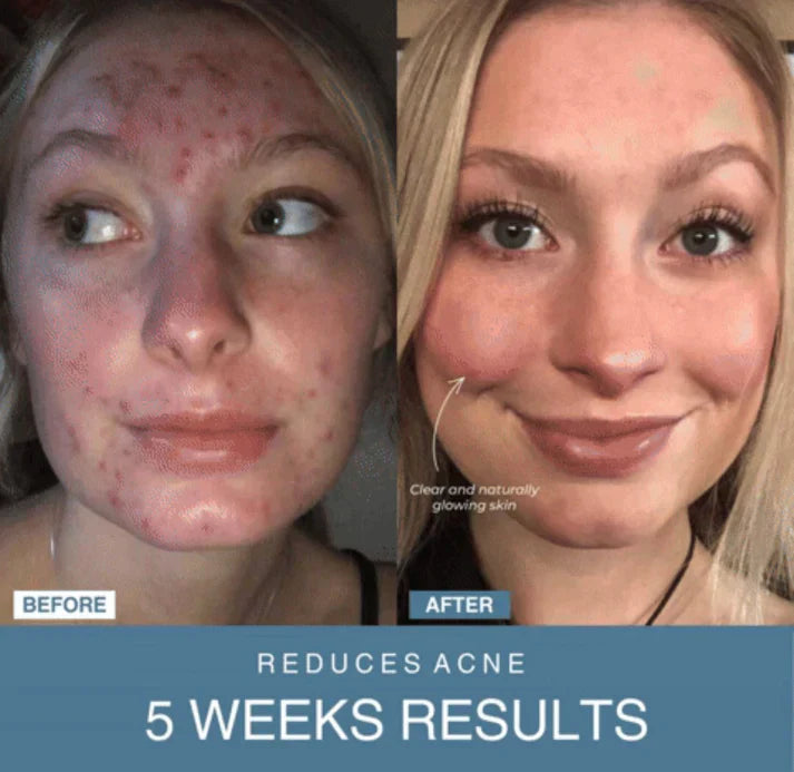 Marketplace Gulf™ 7-in-1 LED Anti-Aging/Wrinkle Apparatus