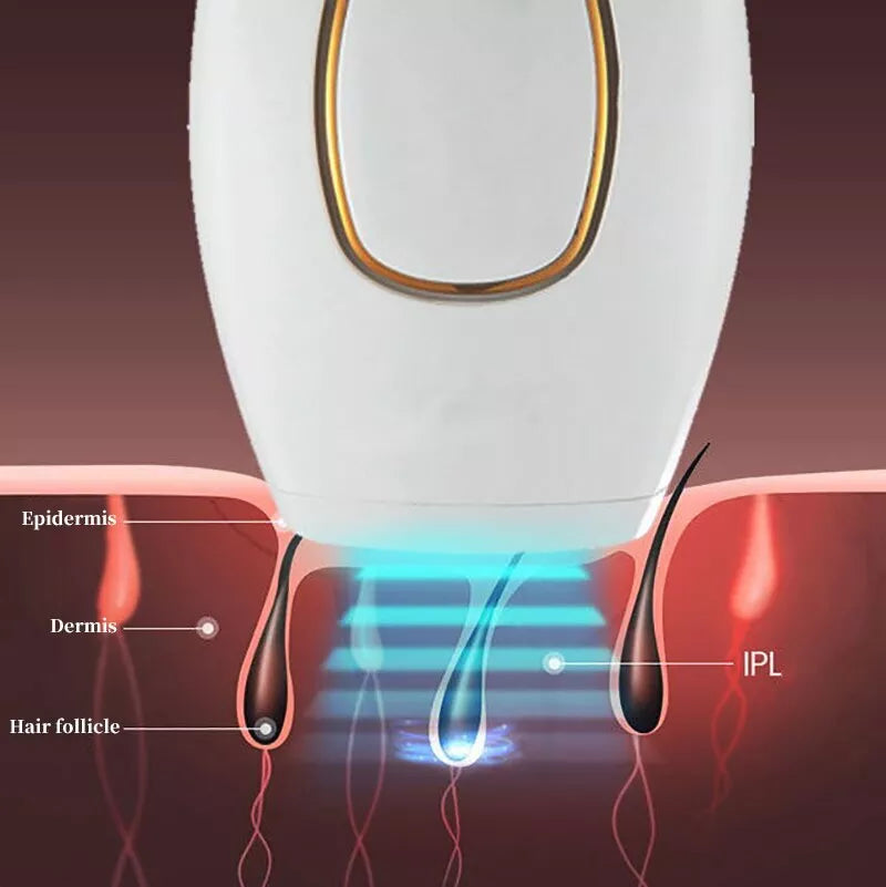 Marketplace Gulf™ IPL Laser Hair Removal – جهاز إزالة الشعر بالليزر IPL